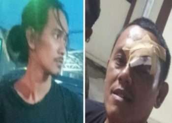 Didampingi puluhan wartawan dan kuasa hukum, Gusti Gumelar atau yang biasa disapa Junot yang berprofesi sebagai wartawan melaporkan tindakan kekerasan dan penganiayaan yang menimpanya, diduga dilakukan oleh oknum pejabat Pemerintahan Daerah Kabupaten Karawang