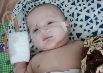 Syafia Adinda Balita kelahiran 20/06/2022, asal Pereupok, Kecamatan Paya Bakong mengalami penyakit bocor jantung