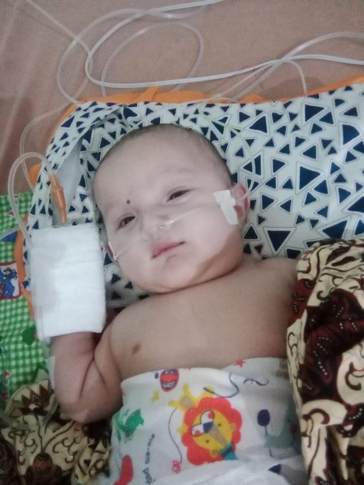 Syafia Adinda Balita kelahiran 20/06/2022, asal Pereupok, Kecamatan Paya Bakong mengalami penyakit bocor jantung