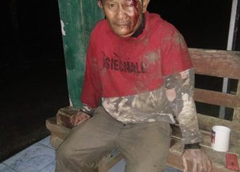 Kondisi Korban Yosafati Zebua Alias Ama Kelvin Zebua