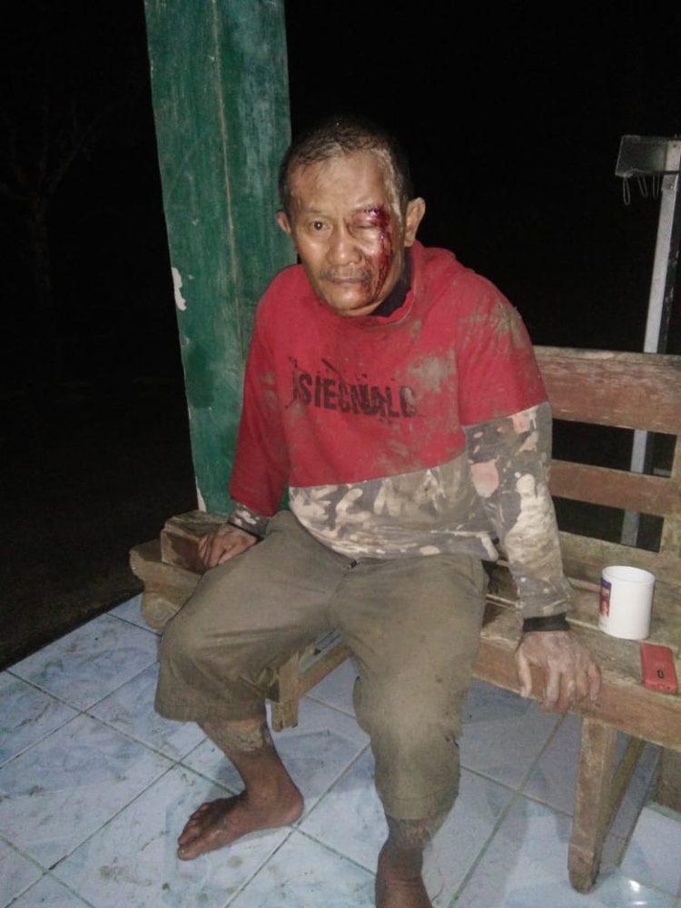 Kondisi Korban Yosafati Zebua Alias Ama Kelvin Zebua
