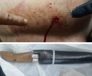 Korban Nanda (18) dan Barang Bukti