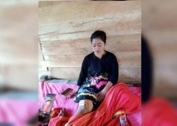 Seorang Ibu Rumah Tangga (IRT) di Kelurahan Ponrangae, Kecamatan Pitu Riawa, Kabupaten Sidrap diserang dua orang laki-laki tak dikenal (OTK), Kamis (26/1/2023)