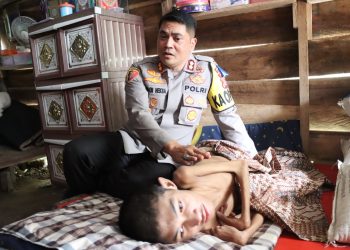 Kapolres Aceh Utara AKBP Deden Heksaputera S, S.I.K., kunjungi rumah warga yang menderita sakit Lumpuh layu serta memberikan bantuan sosial dan tali asih. Kamis, (16/2/2023)