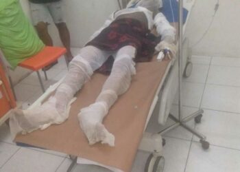 DIBAKAR: Deni saat pertama kali mendapat perawatan medis di RS Muhammadiyah akibat tubuhnya gosong akibat dibakar 2 pria, Rabu (25/10/2023).(Foto Dok/Keluarga Korban)