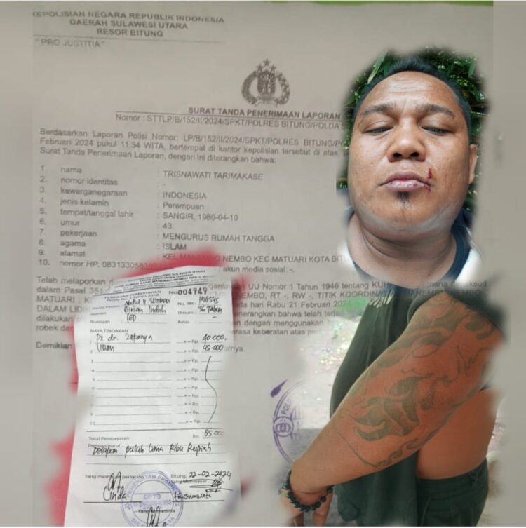 Kondisi Abdul alias Opo Kandang yang mengalami luka di bagian muka dan lebam ditangan kiri dan telah divisum untuk memenuhi laporan pidana kepolisian.