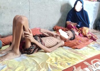 Muhammad Ridha (10) Warga Gampong Matang Puntong Kecamatan Seunuddon Kabupaten Aceh Utara yang saat ini hanya terbaring di rumah tanpa ada perawatan, diduga Penyakit Kanker Getah Bening yang dialaminya sehingga mengarah ke Gizi Buruk