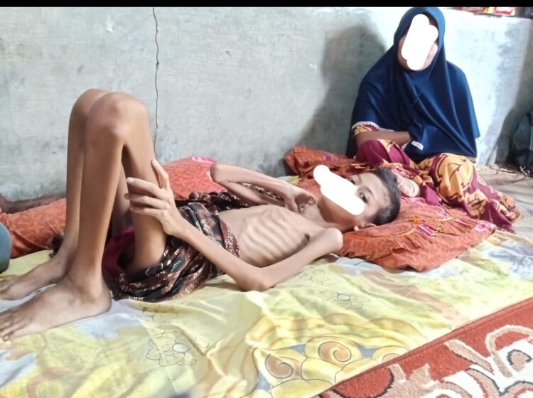 Muhammad Ridha (10) Warga Gampong Matang Puntong Kecamatan Seunuddon Kabupaten Aceh Utara yang saat ini hanya terbaring di rumah tanpa ada perawatan, diduga Penyakit Kanker Getah Bening yang dialaminya sehingga mengarah ke Gizi Buruk