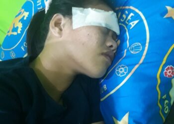 Esterlina segera dilarikan ke Puskesmas Sirombu untuk mendapatkan perawatan atas luka-luka yang dideritanya. Pihak medis di puskesmas mengkonfirmasi bahwa korban mengalami beberapa luka memar dan harus menjalani perawatan lebih lanjut untuk memastikan tidak ada komplikasi serius yang timbul akibat penganiayaan tersebut. Keadaan Esterlina kini stabil, namun masih membutuhkan observasi dan perawatan intensif.