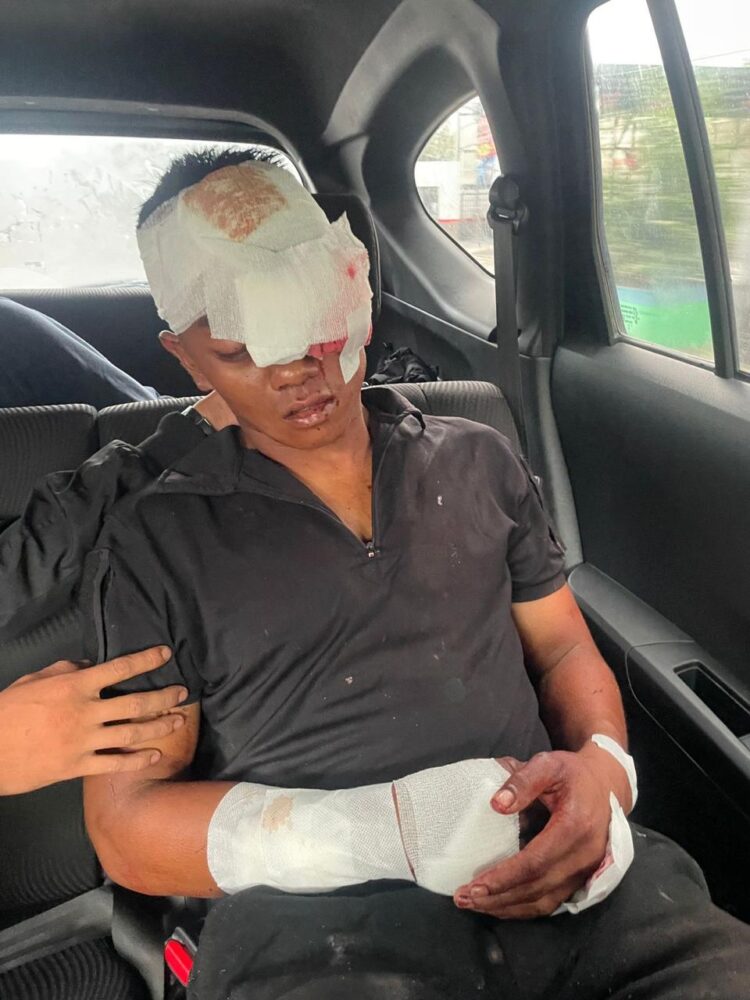 DIBACOK: Seorang anggota TNI berinisial Prada D menjadi korban pembacokan dengan senjata tajam yang dilakukan gerombolan geng motor di Jalan Guru Patimpus, Medan, Minggu (4/8/2024). (Foto Dok/ Polrestabes)