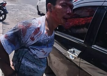 NB: Andre Justen Sinurat - BABAK BELUR: Pelaku curanmor berinisial AJS babak belur dihakimi massa di Jalan Medan Binjai KM 15,5, Desa Diski, Jumat (6/9/2024).(Foto Dok/Warga)