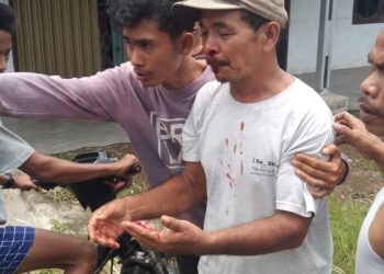 TERLUKA: Seorang pria terluka para di bagian wajahnya akibat dipukul gerombolan geng motor suruhan mafia tanah dengan batu di Jalan Selambo Desa Amplas, Kecamatan Percut Sei Tuan, Deliserdang, Senin (16/9/2024).(Foto Dok/ warga)