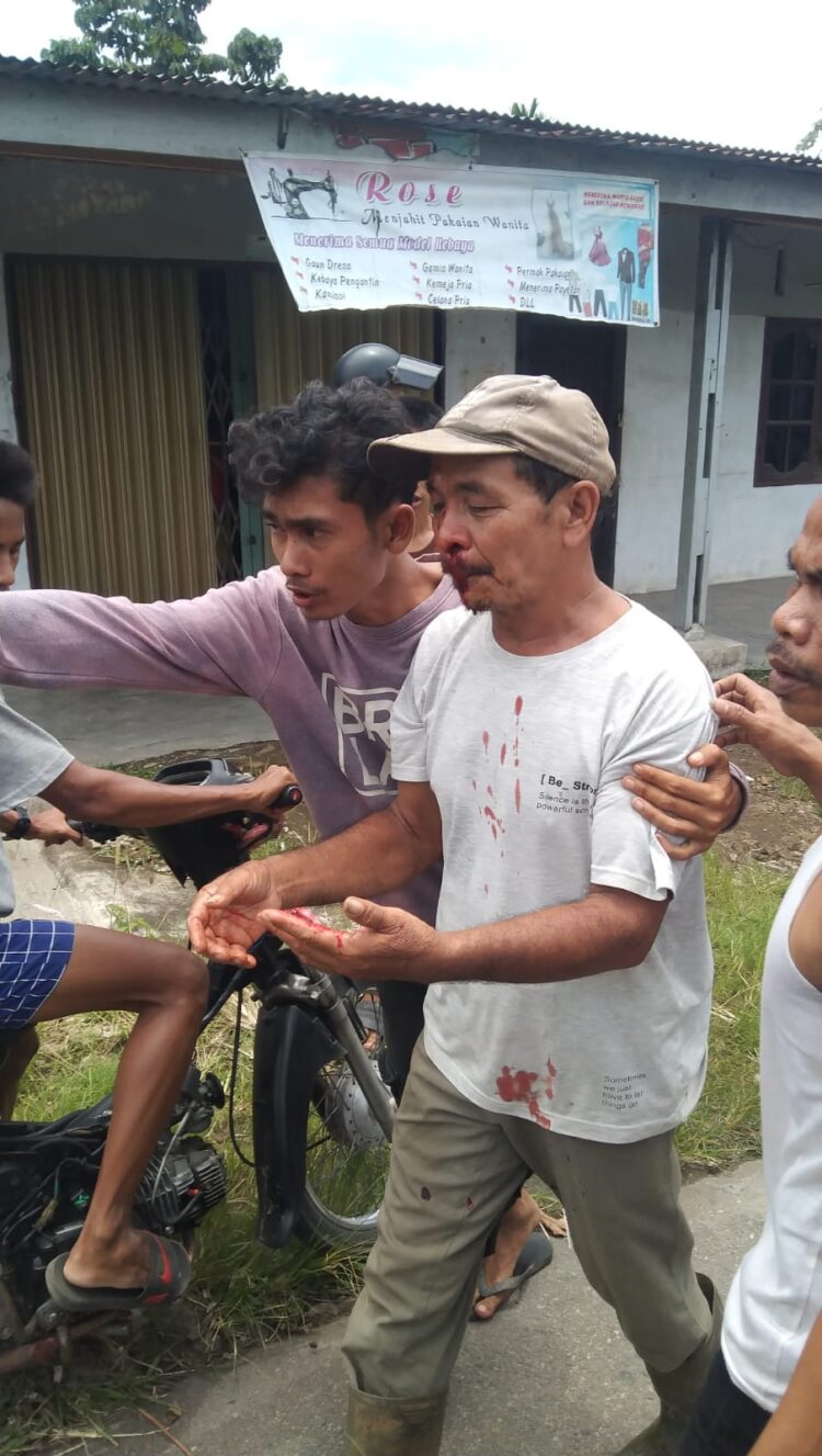 TERLUKA: Seorang pria terluka para di bagian wajahnya akibat dipukul gerombolan geng motor suruhan mafia tanah dengan batu di Jalan Selambo Desa Amplas, Kecamatan Percut Sei Tuan, Deliserdang, Senin (16/9/2024).(Foto Dok/ warga)