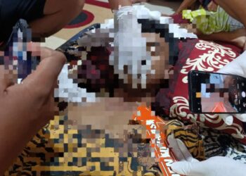 Polsek Wori menerima laporan dari masyarakat mengenai peristiwa gantung diri yang terjadi di Desa Minaesa Jaga I, Kecamatan Wori, Kabupaten Minahasa Utara. Setelah menerima informasi tersebut, piket SPKT segera melaporkan kejadian ini kepada Polresta Manado dan meminta bantuan dari Tim Inafis Polresta Manado untuk mengidentifikasi lokasi kejadian, Minggu (24/11/2024).