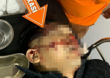 Kondisi korban (AKP Ulil Ryanto) setelah ditembak sebanyak 2 kali dibagian pelipis kanan dan pipi kanan (Foto. Dok: Polres Solok Selatan)