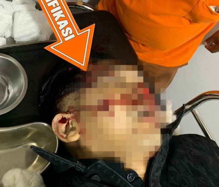 Kondisi korban (AKP Ulil Ryanto) setelah ditembak sebanyak 2 kali dibagian pelipis kanan dan pipi kanan (Foto. Dok: Polres Solok Selatan)