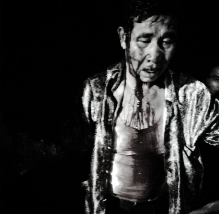 Korban atasnama Atuloo Gulo alias Ama Yanu Gulo, warga Desa Lolozirugi, kecamatan mandrehe, kabupaten Nias Barat