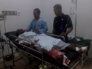 45 Persen Badan Alami Luka Bakar, Satu Korban Ledakan Petasan Koma