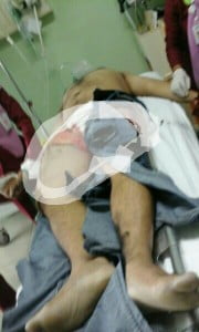 Kecelakaan di Kaligawe, Seorang Lelaki Tewas di Tempat