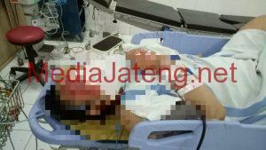 Terlindas Truk Tangan Kiri Wanita Paruh Baya Putus