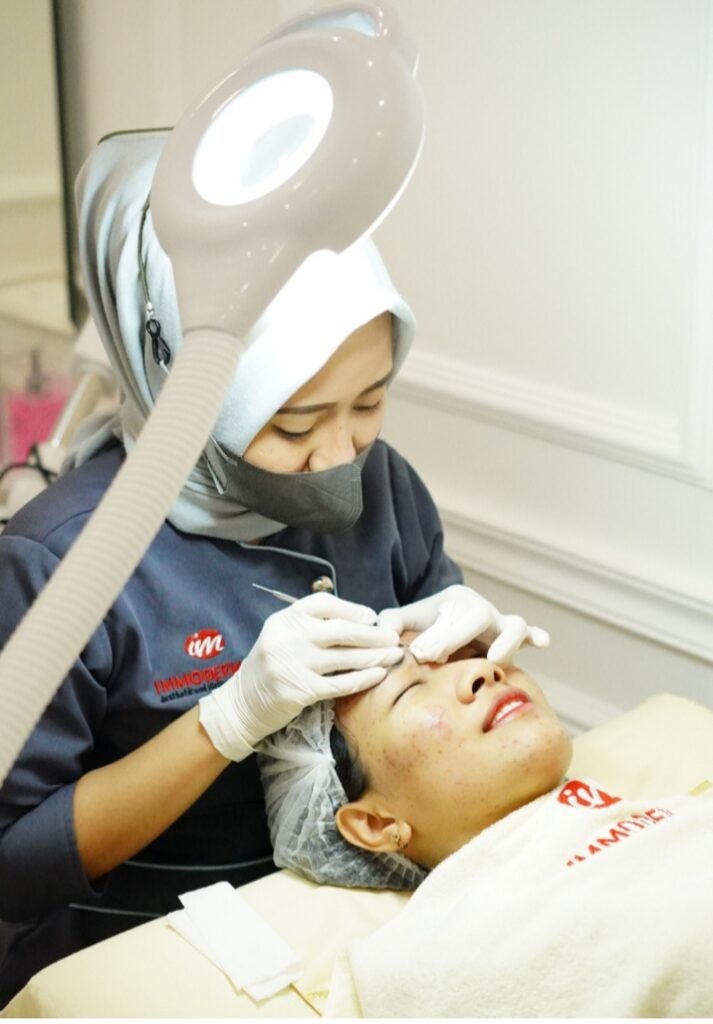 Immoderma Cabang Supriyadi Semarang Tawarkan Perawatan Kulit dengan Harga Terjangkau