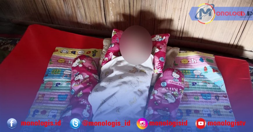 Bayi Penderita Jantung Bocor di Tulangbawang Barat Butuh Uluran Tangan Dermawan