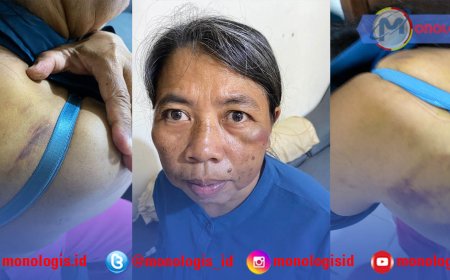 Aniaya ART, Oknum Dokter PNS di Bandarlampung Dilaporkan ke Polisi