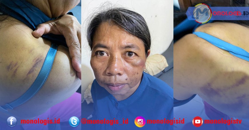 Aniaya ART, Oknum Dokter PNS di Bandarlampung Dilaporkan ke Polisi
