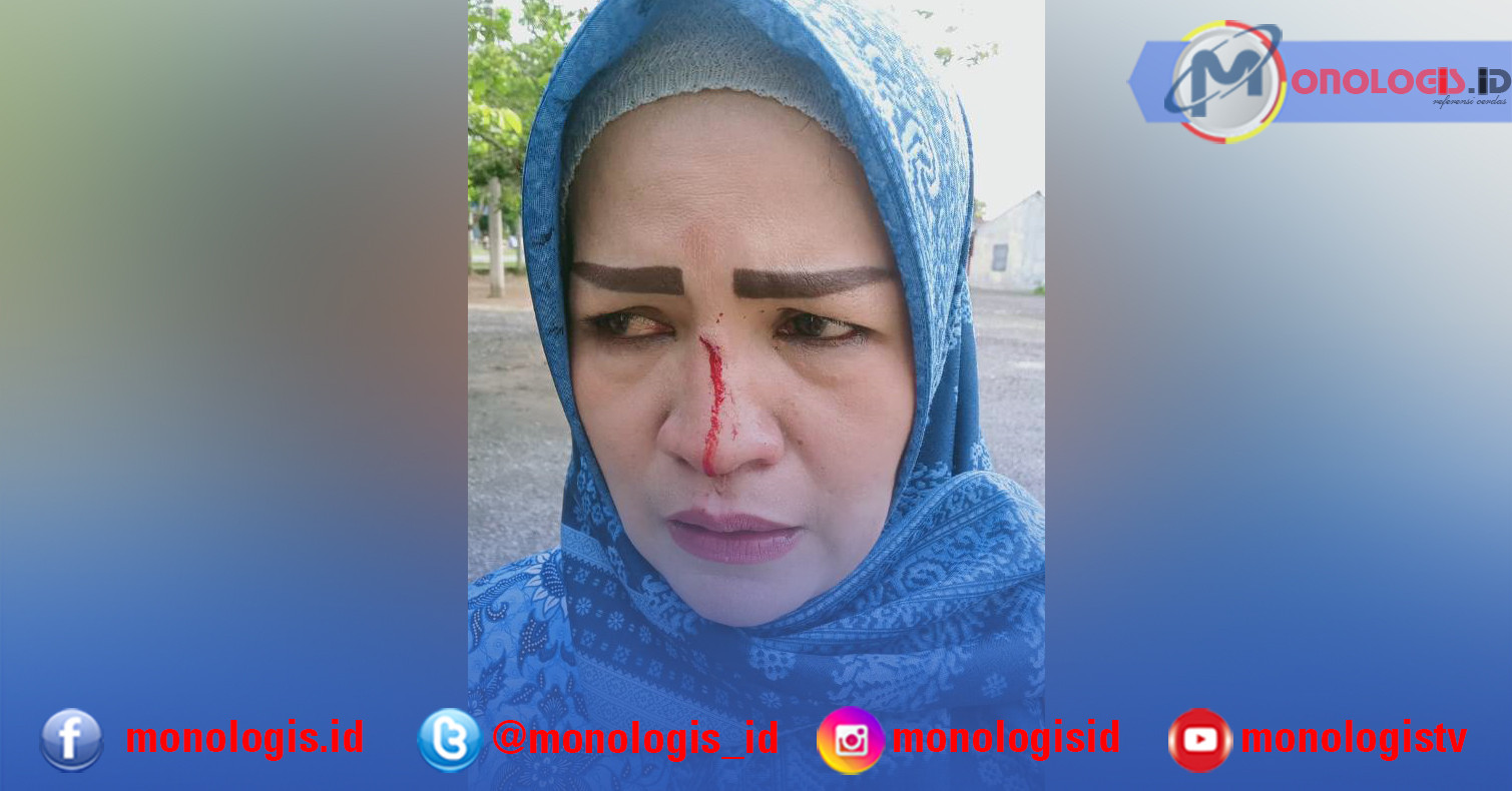 Dianiaya Rekan Kerja, Honorer Dinas Pendidikan Tulangbawang Luka Robek di Hidung