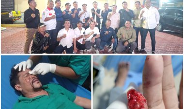 Diduga Ditipu dan Dianiaya oleh Adik Ipar, Seorang advokat dan istrinya di Bogor Laporkan Kasusnya ke Polresta