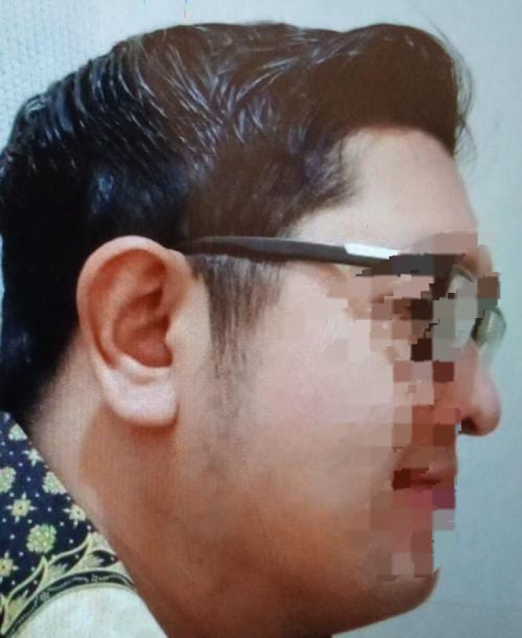 *Oknum BNPT Aniaya Warga Menggunakan Senjata Api, Sejak 2023 Belum Ada Kejelasan APH Polres Bogor Menjadi Sorotan?*