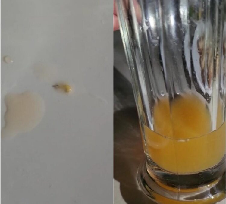 Pelanggan Temukan Ulat Dalam Jus Jeruk di Kafe Kopi Sio Pematang Siantar