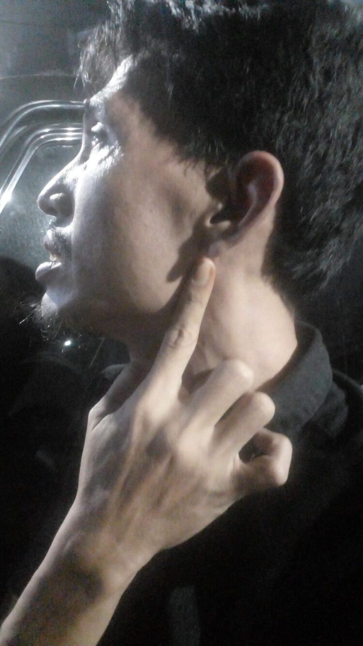 Antar Kursi Pijat untuk Go Lie Sian, Karyawan Pengiriman Barang dari Medan Dianiaya Sopir Pengusaha Pematangsiantar