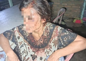 Seorang Wanita Dianiaya Tetangga di Samping Masjid Nagori Silau Malaha
