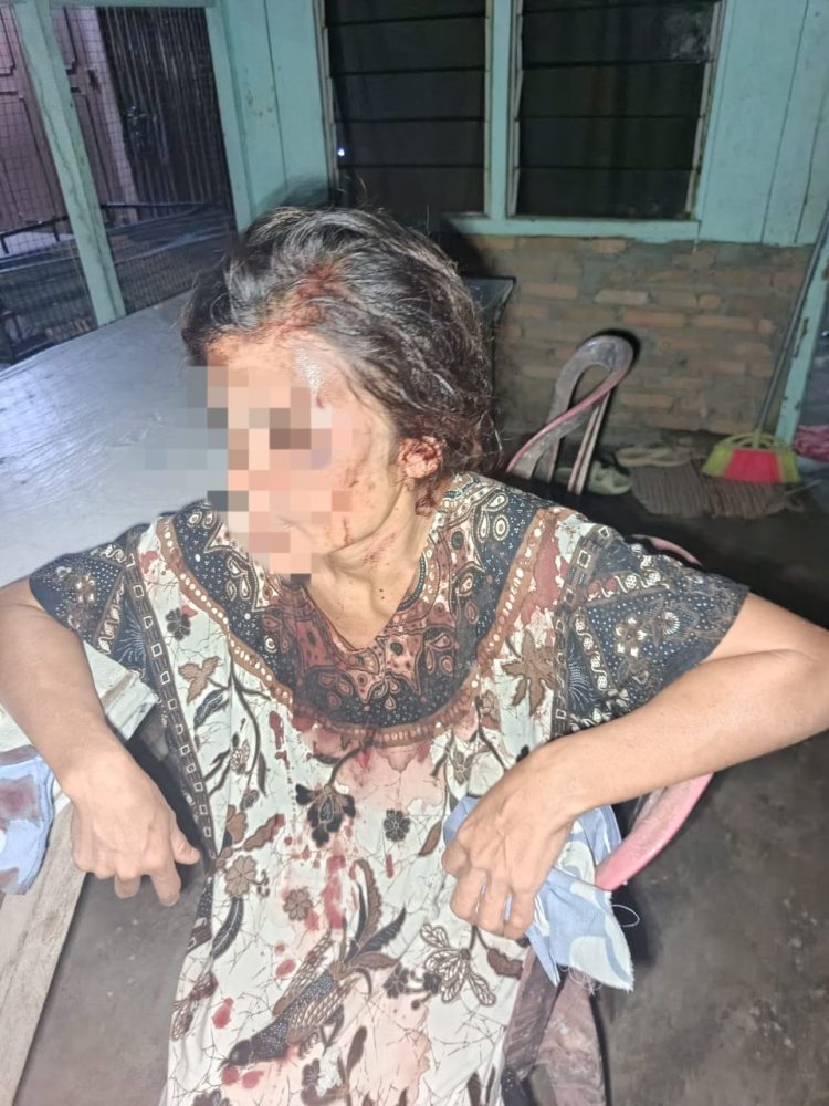 Seorang Wanita Dianiaya Tetangga di Samping Masjid Nagori Silau Malaha