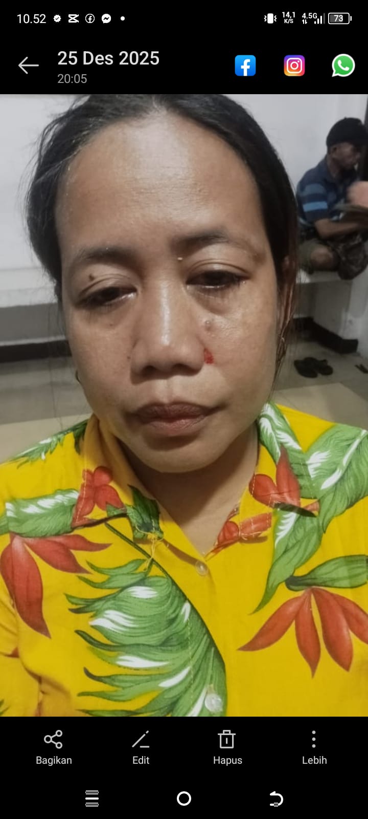 Sembilan Bulan Lamanya, Polisi Polsek Siantar Utara Dinilai Lamban Tangani Kasus Penganiayaan IRT