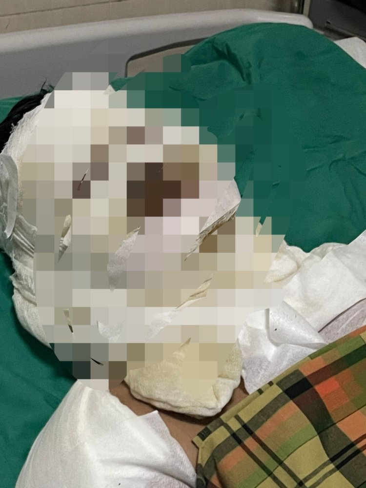 Diduga Langsir Minyak Subsidi, Mobil Terbakar di SPBU KM 13 Muaro Jambi — Polisi Selidiki Unsur Pelanggaran Hukum