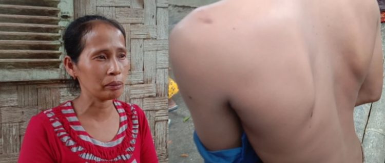 Foto : Supiana mengamati badan anaknya yang lebam karena diduga dianiaya. (foto/dmk)