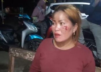 Suzanna, istri di Makassar dihajar suami karena tidak izin menginap di rumah tetangga. (Foto: iNews/Muhammad Nur Bone)