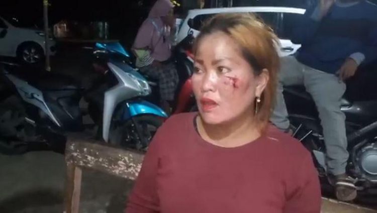 Suzanna, istri di Makassar dihajar suami karena tidak izin menginap di rumah tetangga. (Foto: iNews/Muhammad Nur Bone)