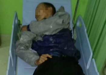 Foto mayat korban, diduga meninggal karena tabrak lari.