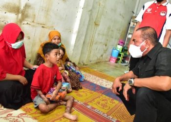 Edy saat menjenguk 2 anak dengan sakit kulit di Madina (dok. Pemprov Sumut)
