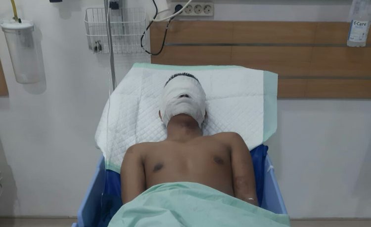 Kondisi korban yang mendapat perawatan medis di RS Adam Malik Medan.