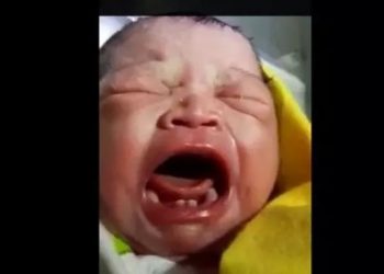 Bayi baru lahir di Sumut sudah miliki gigi. [ANTARA]