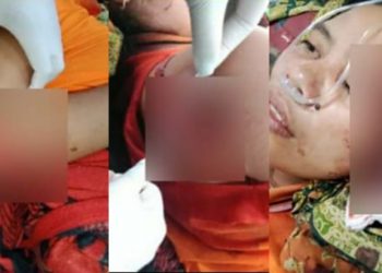 Suryani terkulai lemas di ruang perawatan rumah sakit usai dibacok secara membabibuta oleh suaminya karena cemburu. Foto: Istimewa
