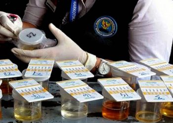 Foto ilustrasi test urine. (Int)