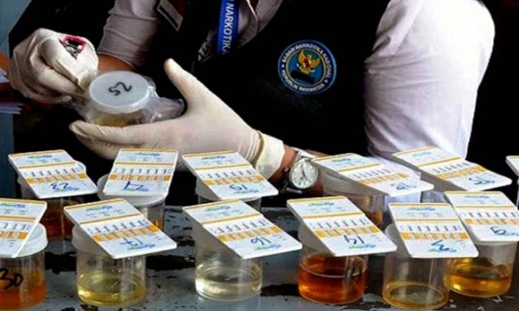 Foto ilustrasi test urine. (Int)