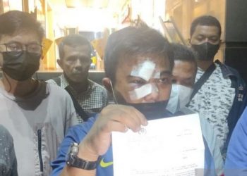 Ketum KNPI Haris Pertama melaporkan peristiwa pengeroyokan yang dialaminya di salah satu restoran di Cikini, Jakarta Pusat, ke Polda Metro Jaya, Senin malam (21/2). [Ist]
