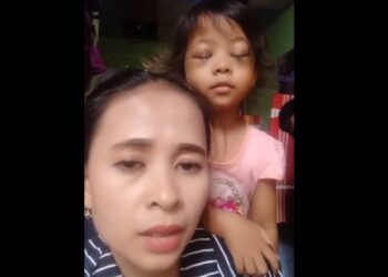 Seorang ibu tunjukkan mata anaknya yang bengkak usai main HP (Foto: tangkapan layar)