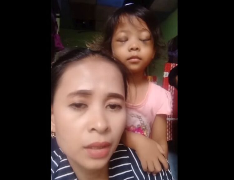 Seorang ibu tunjukkan mata anaknya yang bengkak usai main HP (Foto: tangkapan layar)